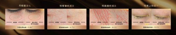 革新细胞级抗衰以PDRN科技开启功效护肤新纪元OG网站RENAIS MODA 芮纳斯耀世启幕(图2)